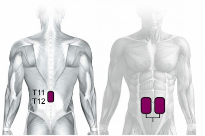 Update zur transkutanen Rückenmarkstimulation